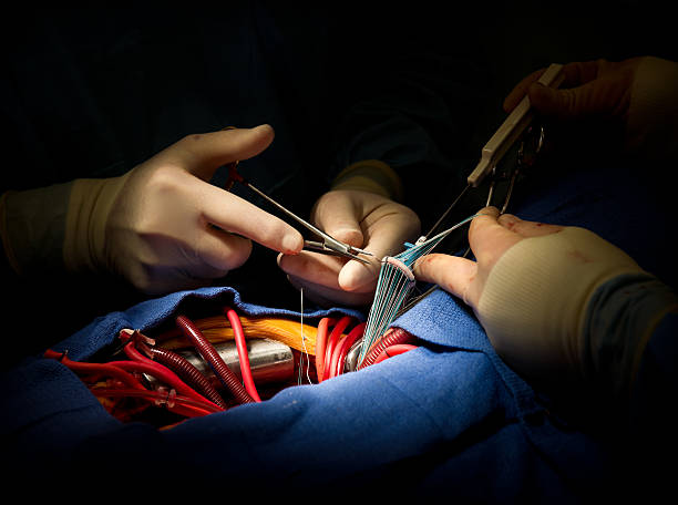 surgeon performing heart surgery