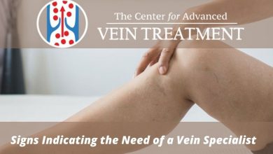 Photo of Signs Indicating the Need of a Vein Specialist