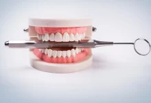 Photo of Essential Considerations for Installing and Caring for Dentures